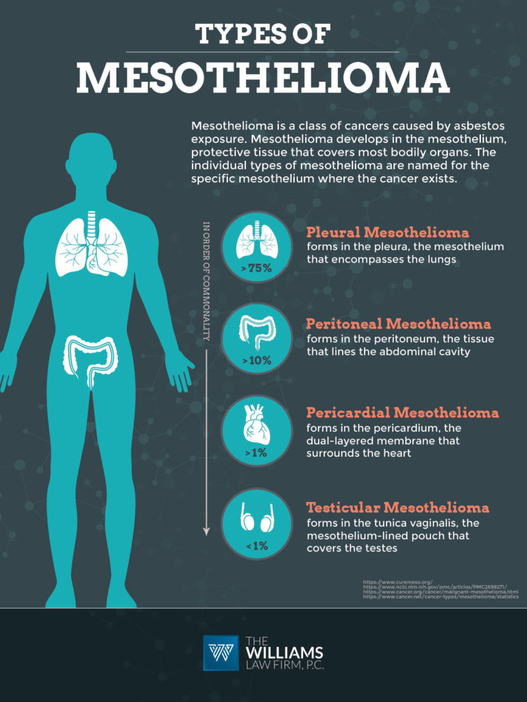 graphic representation of the types of mesothelioma
