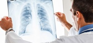 doctor examines chest x-ray