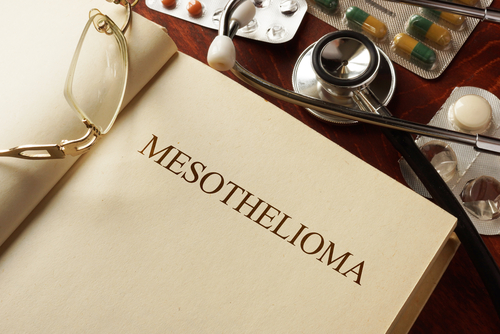 end stage of mesothelioma