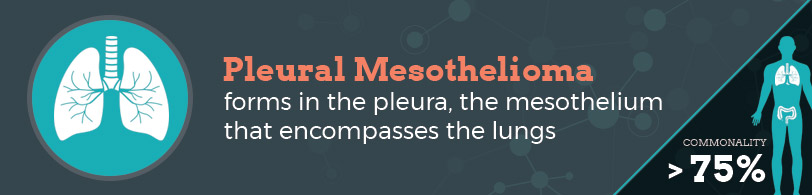 graphic representing pleural mesothelioma