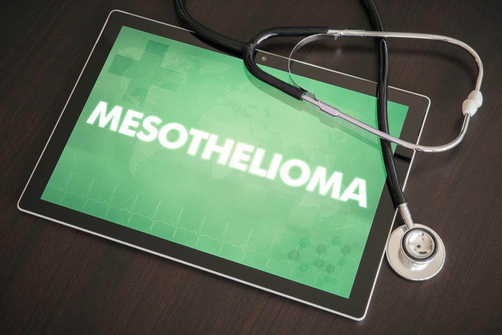 What Are the Different Types of Mesothelioma? The Williams Law Firm(04)